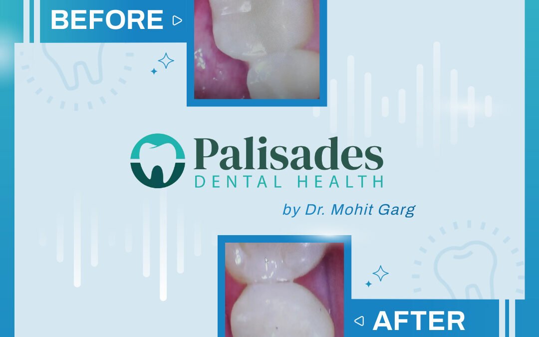 Before After By Dr. Mohit Garg