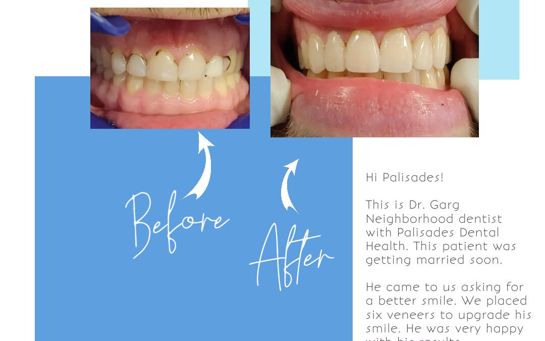 Take care of your smile