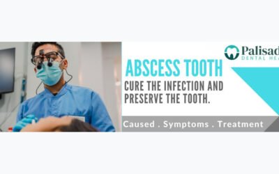 Abscess tooth cure the infection and preserve the tooth