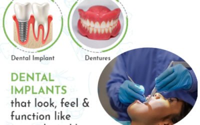 Dental Implants that look, feel & function like natural teeth!