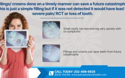Filling/crown done on a timely manner can save a future catastrophe