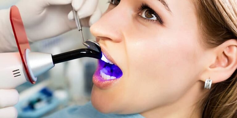 The Benefits and Process of Tooth Bonding: A Quick and Effective Way to Improve Your Smile