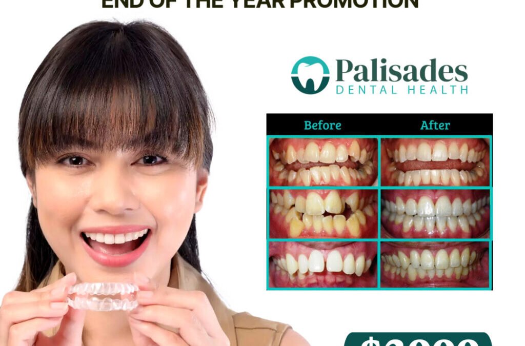 Clear Aligners End of the Year Promotion