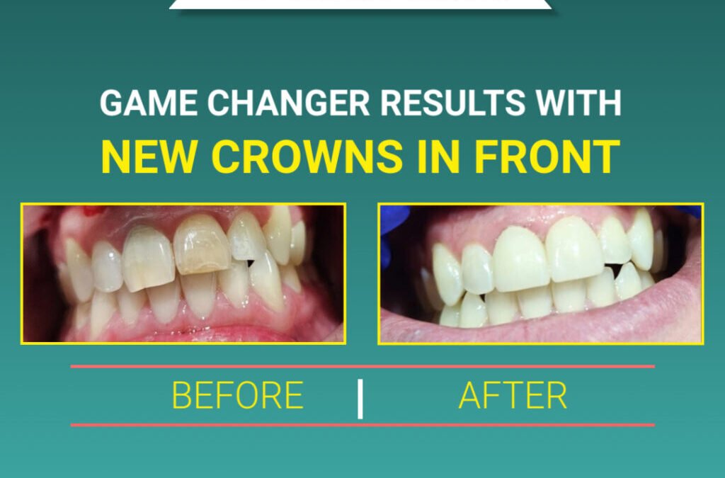 Game Changer Results