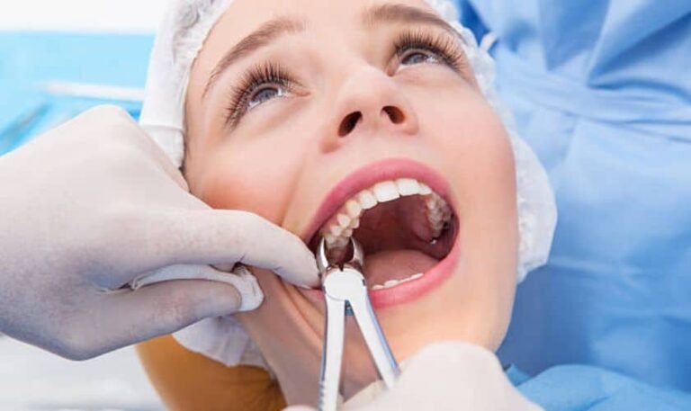 Painless Tooth Extraction: A Stress-Free Experience