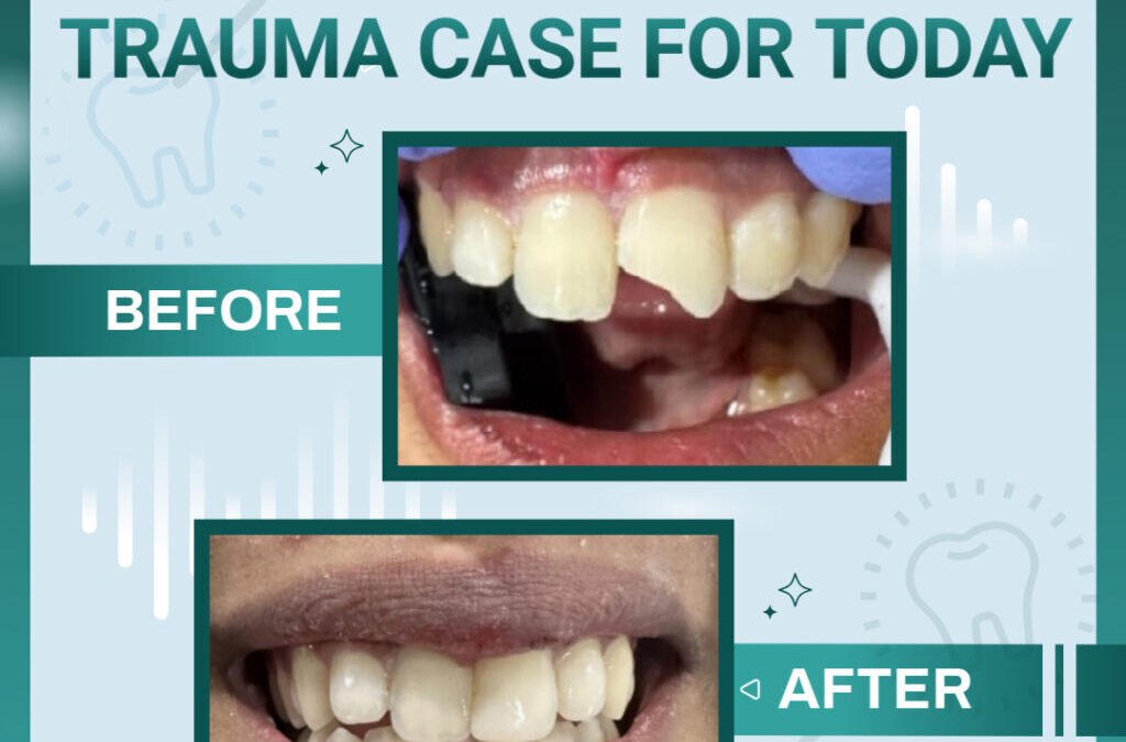Trauma Case of the Day