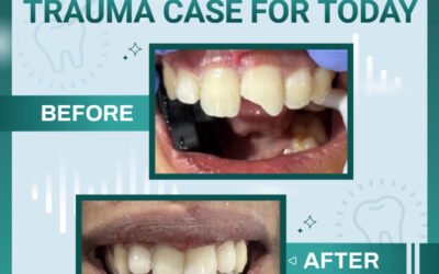 Trauma Case of the Day