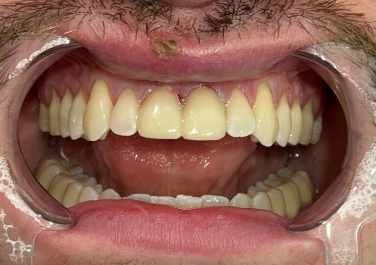 Trauma Case of the Day — After