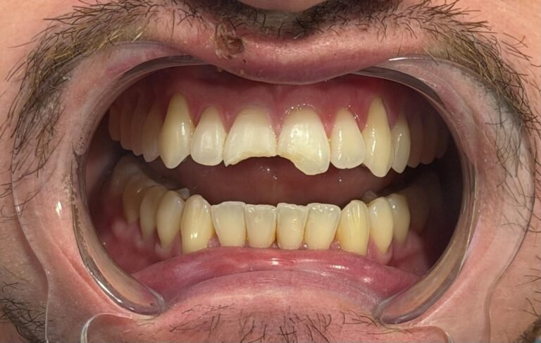 Trauma Case of the Day — Before