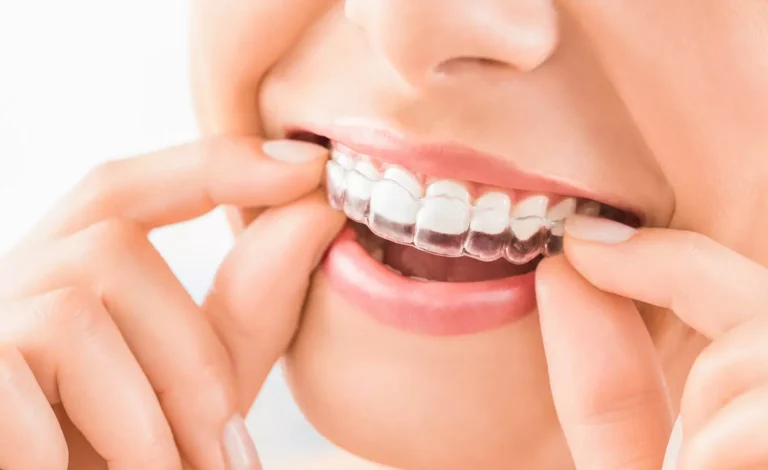 Night Guards or Dental Implants